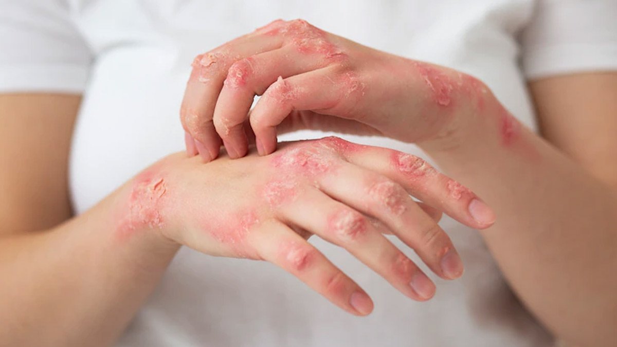 dr satyarapelliNatural healing remedies